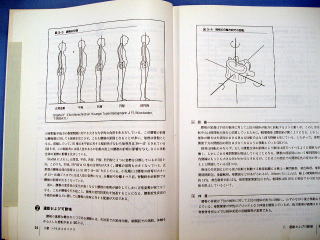 カイロ矯正